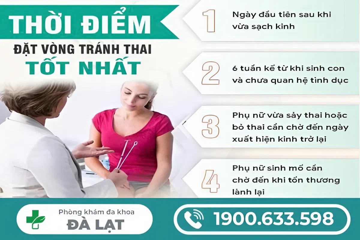 Hình ảnh minh họa